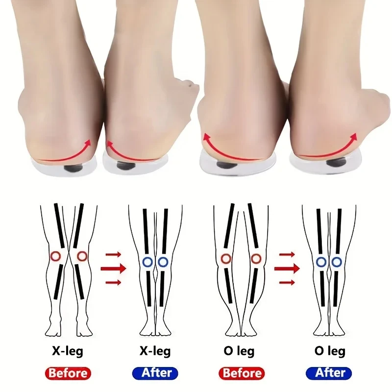 1 pasang sol dalam ortopedi un - Women Shoes Types ulasan dan harga