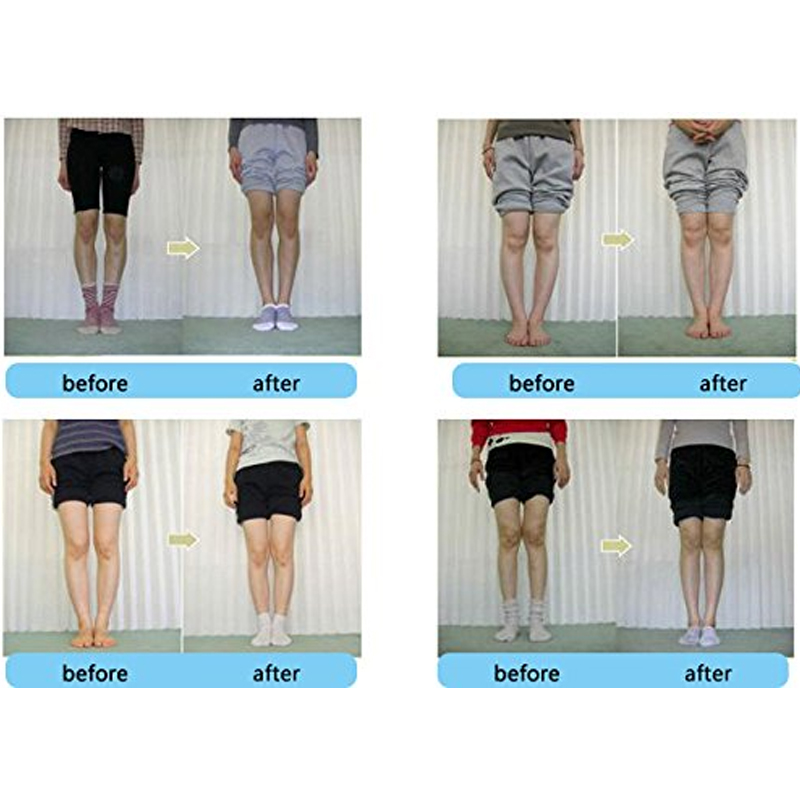 Tcare 1 Pasang Sol Ortopedi Si - Women Shoes Types ulasan dan harga